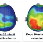 Benefici del camminare sul cervello